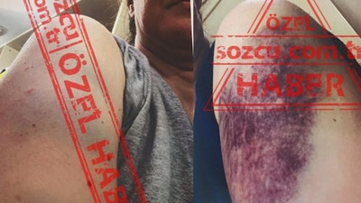 Şok iddialar: Mert Çiller eşini dövdü! Dayak, şiddet, fuhuş, tehdit...