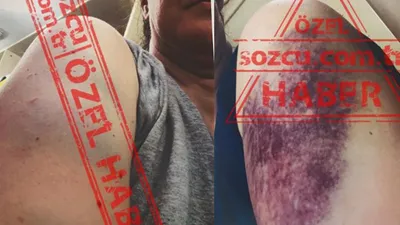 Şok iddialar: Mert Çiller eşini dövdü! Dayak, şiddet, fuhuş, tehdit...