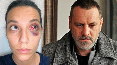 Deniz Bulutsuz'un darp raporu ortaya çıktı