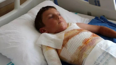 Küçük çocuk kendini yaktı! 