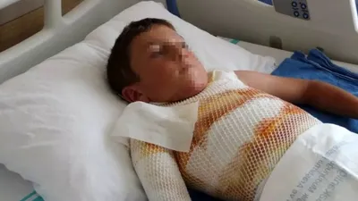 Küçük çocuk kendini yaktı! 