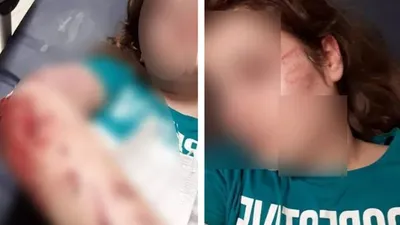 Darp edilen genç kız kendini 2. kattan attı
