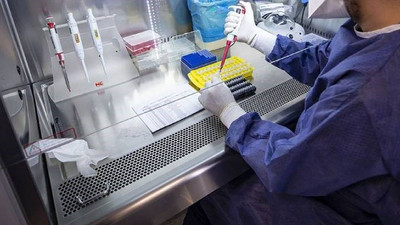 Dolarla yaşamıyorduk değil mi ? Zorunlu PCR testine yüzde 127 zam geldi!