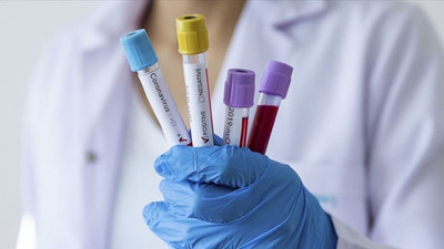 Türk Tabipleri Birliği'nden ''Temaslılara test yapılsın'' çağrısı
