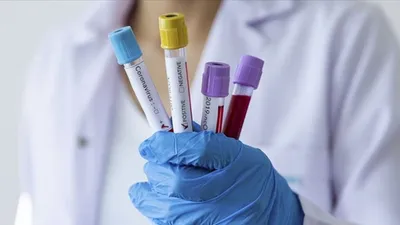 Türk Tabipleri Birliği'nden ''Temaslılara test yapılsın'' çağrısı