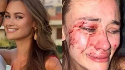 Bakan Ersoy'dan Çeşme'deki darp olayıyla ilgili sert açıklama