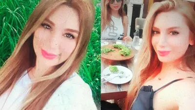 Botoks faciasında şoke eden detaylar! Kürtaj da yapmışlar