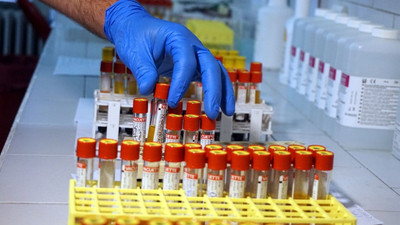 Koronavirüste yeni umut: Ölümleri yüzde 85 azaltıyor