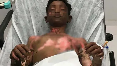 Ateşe tiner döken gençlerin korkunç sonu