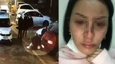 İstanbul'da genç kadına polis dayağı iddiası: ''Doktor az bile yapmışsınız dedi''