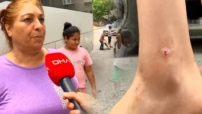 Sivrisinek deyip geçmeyin; hemen hastaneye başvurun!