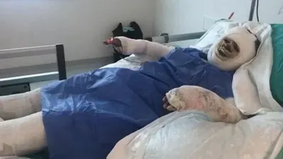 Eşine kızdı, kayınvalidesini benzin döküp yaktı