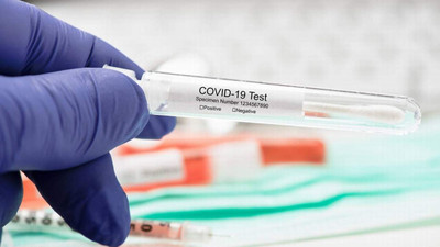 PCR testlerinde varyant endişesi