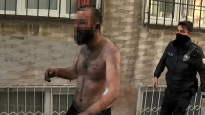 Yürek yakan anlar: Yaralı halde ambulanstan inip yanan evini gezdi