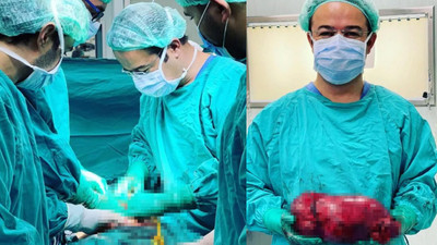 Doktorları bile şaşkına çeviren olay: Tam 30 santimetre...
