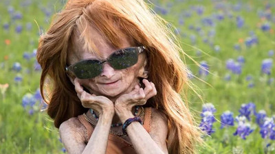 Benjamin Button sendromlu ünlü Youtuber 15 yaşında hayatını kaybetti