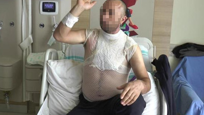 Suyun sıcak olduğunu unutan adam hastanelik oldu