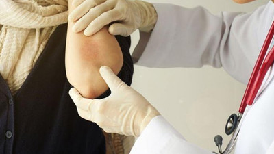 Kurdeşen döküntüsü olanlar için uyarı: Kovid-19 habercisi olabilir