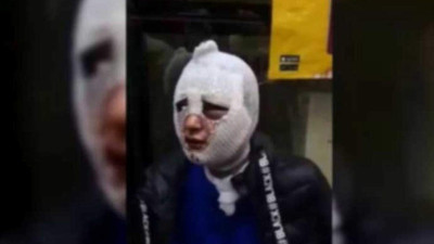 Zorla evine girdiği kadını kızgın yağ dökmekle suçlanıyordu... Tahliye edildi!