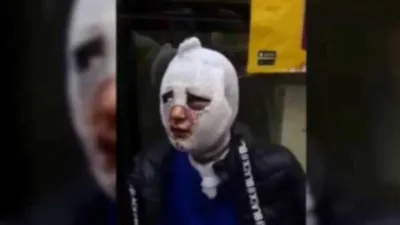 Zorla evine girdiği kadını kızgın yağ dökmekle suçlanıyordu... Tahliye edildi!