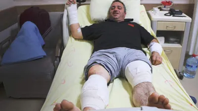 Ayıyı dize getirmişti, keneye yenildi