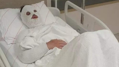 Genç kadına kimyasal saldırıda ''yuh'' dedirten savunma