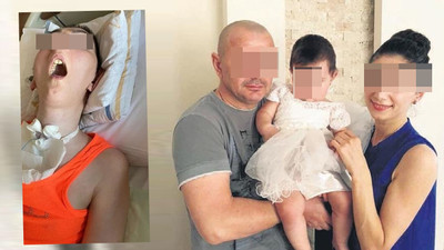 Estetik uğruna kabusu yaşadı: 4 yıldır bitkisel hayatta!