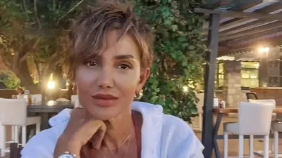 Estetik sonrası Serap Paköz'ü gören tanıyamadı