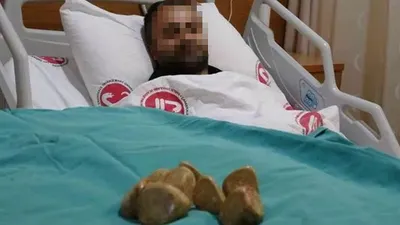 Karın ağrısı şikayetiyle hastaneye gitti, mesanesinden çıkanlar ''yok artık'' dedirtti
