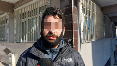 Sokak ortasında kadına şiddette kör kurşun ona isabet etti
