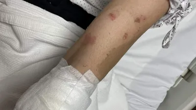 Lavabo açıcı bomba gibi patladı, genç kadın ölümden döndü