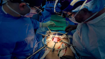 Organ naklinde devrim niteliğinde hamle: Domuz böbreği insan vücudunda çalıştırıldı...