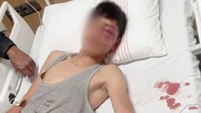 Suriyeli çocuğa işkence ve cinsel istismar iddiası