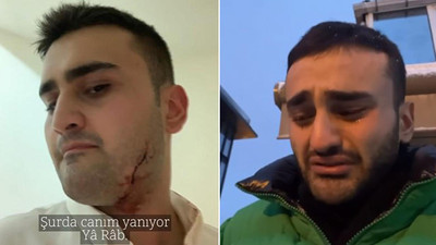 CZN Burak'ın vücudundaki yara izlerinin sırrı çözüldü