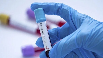 20 milyon kişiyle koronavirüs araştırması sonuçları