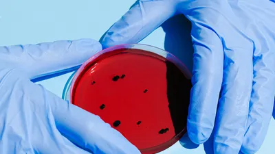 Binlerce kişiye HIV ve hepatit virüslü kan verildi