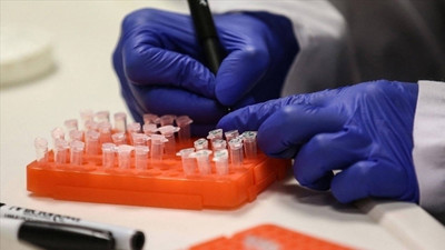 Maymun çiçeği virüsü bir ülkeye daha sıçradı