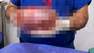 Ağrı şikayetiyle giden kadının karnından 3 kiloluk kitle çıkarıldı