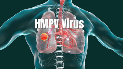 Çin'de görülen HMPV virüsü Türkiye için risk mi ?