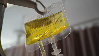 Peş peşe ölümler sonrası bakanlıktan hayati uyarı: Sarı serum ne zaman uygulanmalı?