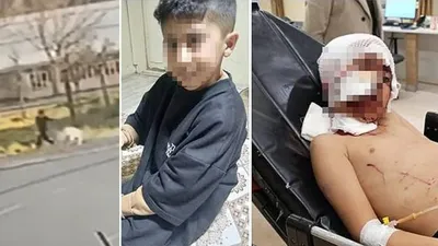 Başıboş köpekler iki çocuğa daha saldırdı