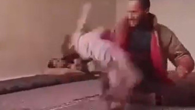 Bu nasıl vicdansızlık! 2 yaşındaki kıza kan donduran şiddet