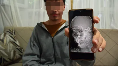 Sokak magandaları yüzünden 1,5 yıldır her gün ölüm korkusuyla yaşıyor!