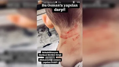 Rehabilitasyon merkezinde 5 yaşındaki çocuğa darp skandalı