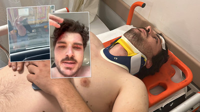 Genç oyuncu trafik magandalarının saldırısına uğradı: 3'ü birden linç etti!