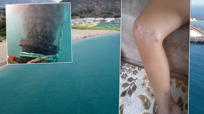 Antalya'da deniz enfeksiyonu alarmı: Denize giren çocuğun vücudu lekelerle kaplandı!