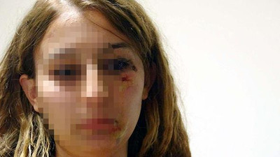 Kadın polisi kuaförde dövdüler !