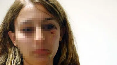 Kadın polisi kuaförde dövdüler !