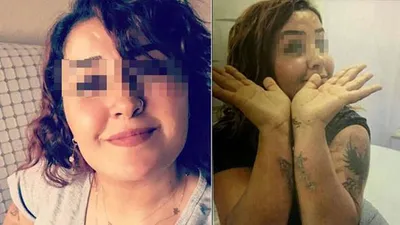 Tek isteği dövmesini sildirmekti... Kabusu yaşadı !