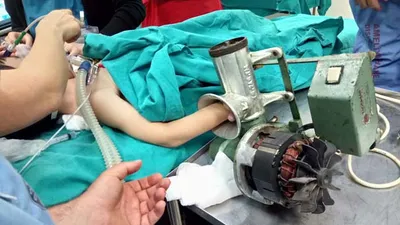 Çocuğun eli kıyma makinesine sıkıştı